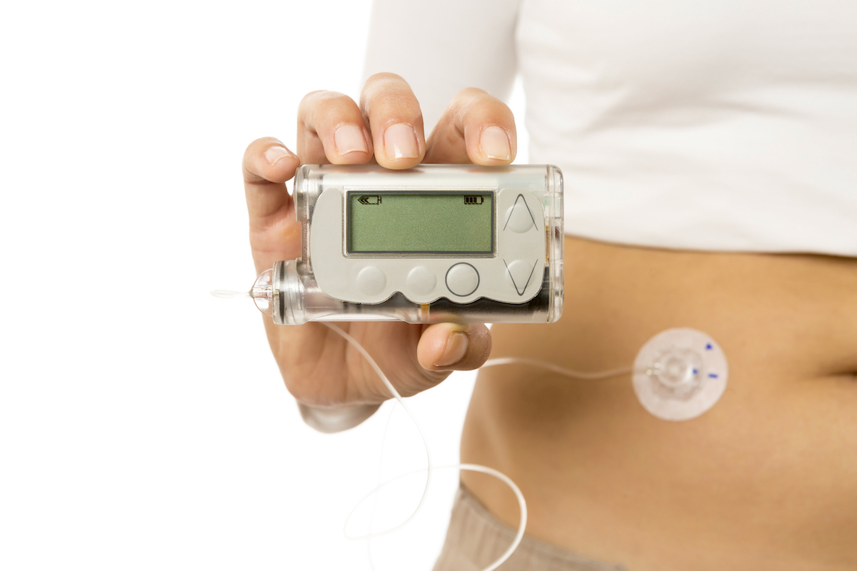 Continuous Glucose Monitor and insulin pump