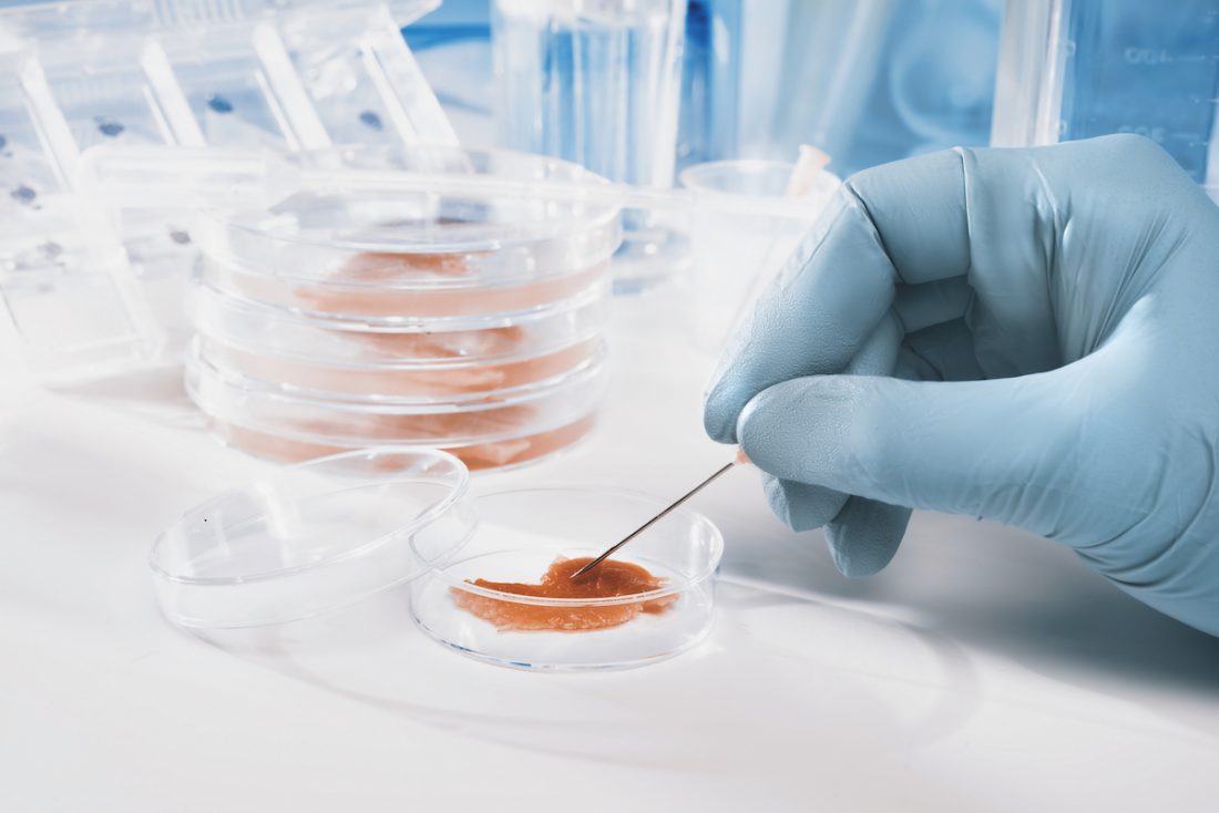 Test-tube meat Tech that can change the future.